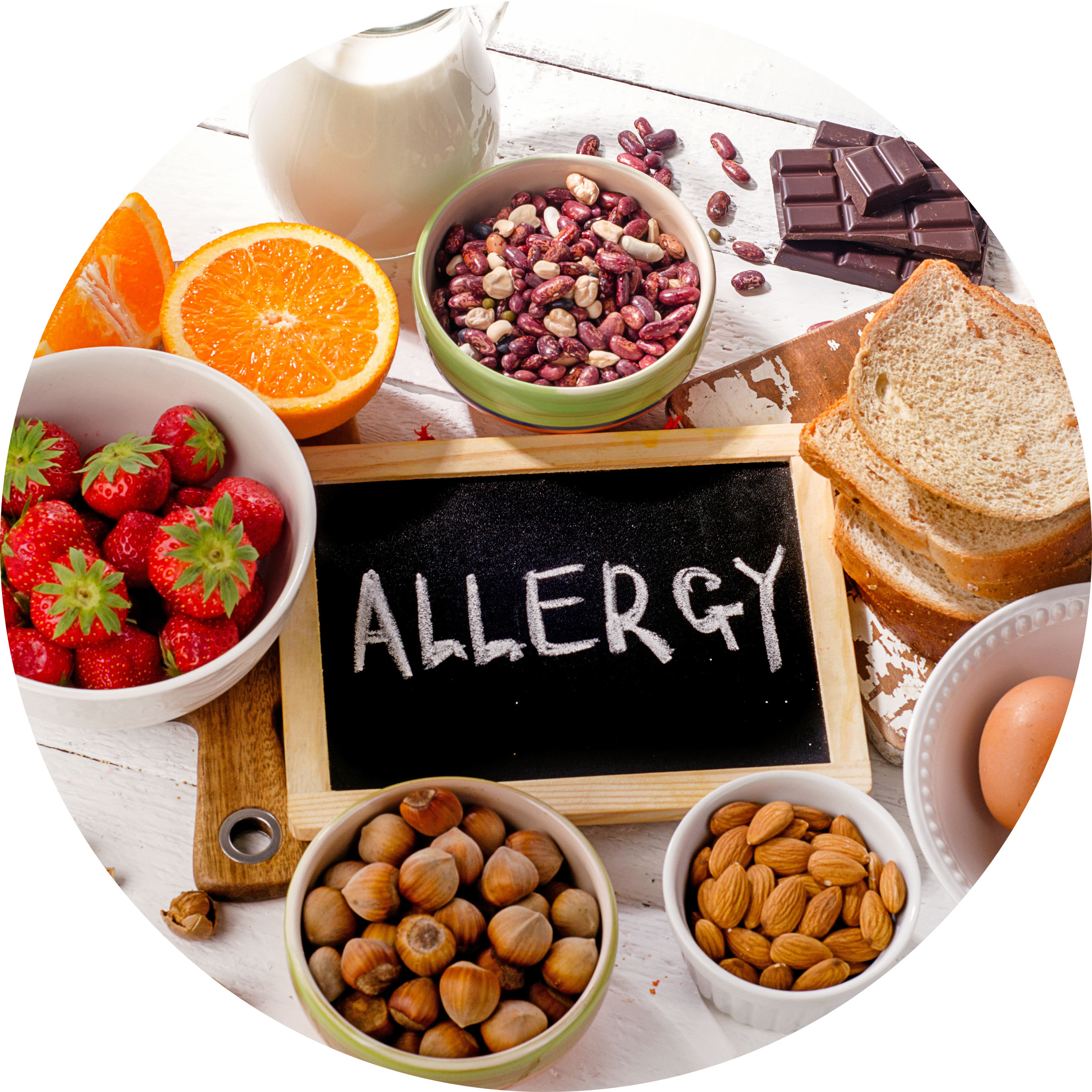 Allergia alimentare