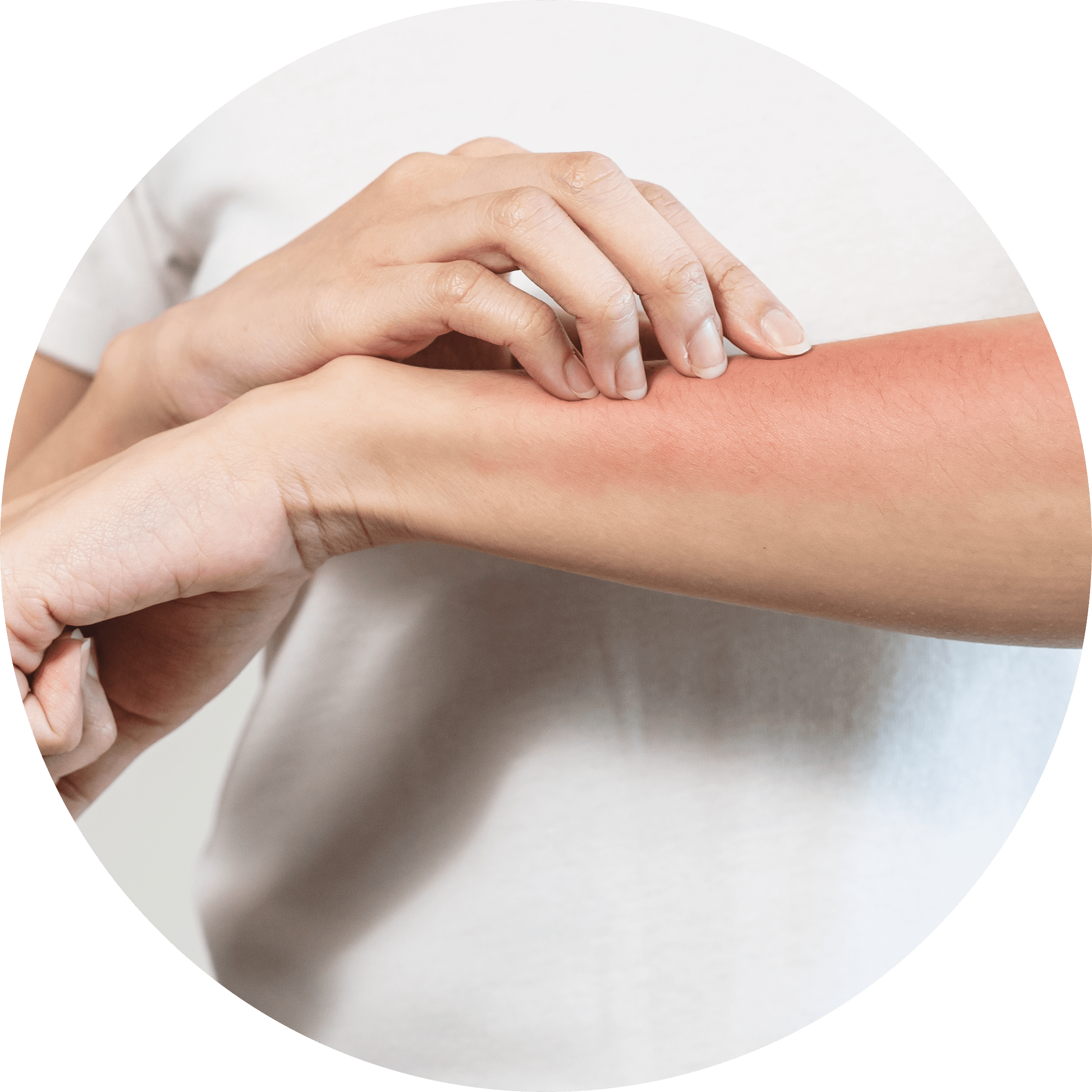 Dermatite allergica da contatto