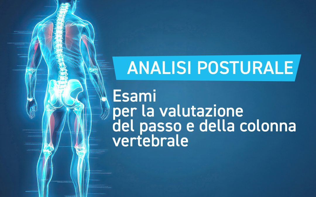 Analisi Posturale