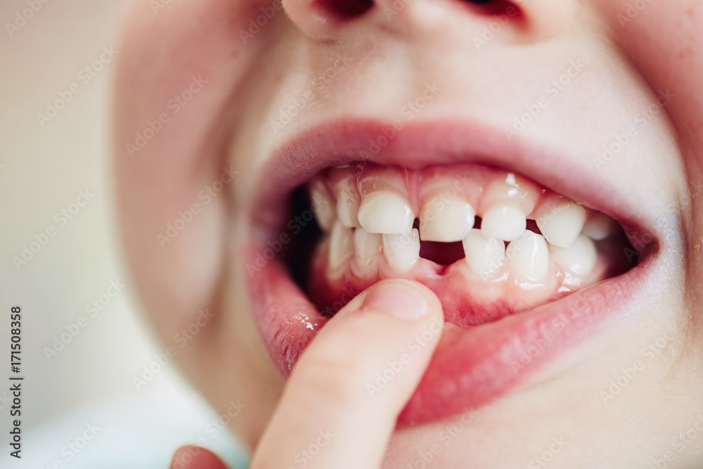 Dettaglio controllo odontoiatrico pediatrico
